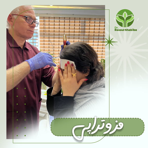 مزوتراپی + دکتر رسول شکیبا