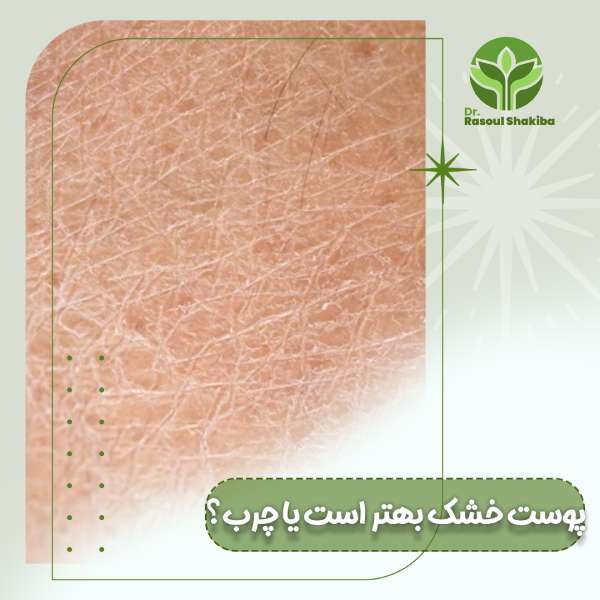 پوست چرب یا خشک