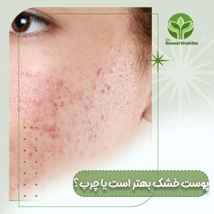 پوست چرب بهتر است یا خشک