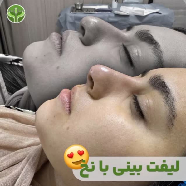 لیفت-نخ-01